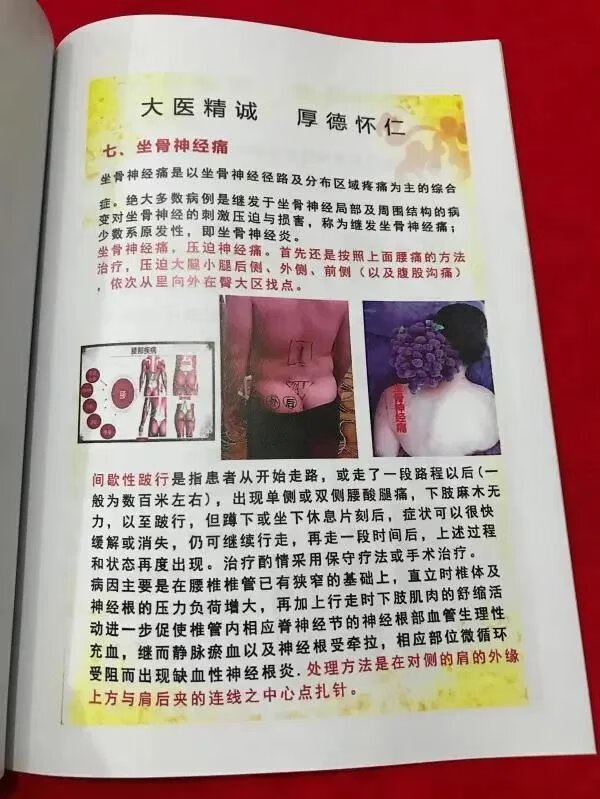 李红兵,李氏疼痛开关一手资料!实体书高清大图