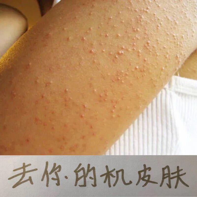 去除腿部鸡皮肤用什么药膏(腿上的鸡皮肤用什么可以去除)