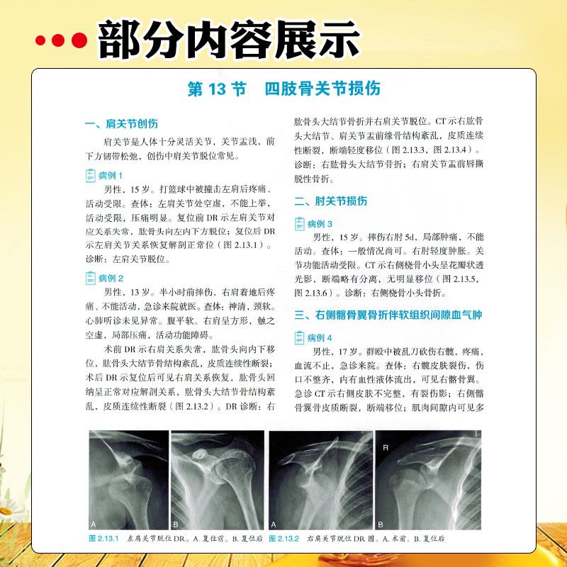 [正版] 儿童临床影像诊断图谱 世界图书出版公司 9787523203743图片