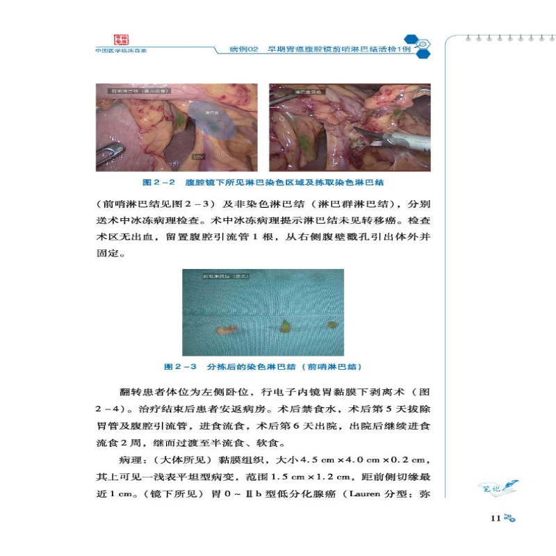 [M]中国医学科学院肿瘤医院胃癌病例精解-9787518986392高清大图