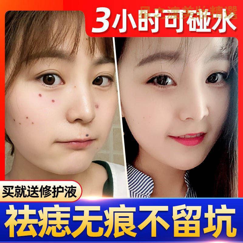 樱色须泡 膏 啫喱 优选好货 去痣点痣药水非祛斑笔无痕正品祛痣神器祛痣膏修复液去斑黑点脸部 价格图片品牌报价 苏宁易购星之渡美妆个护专营店