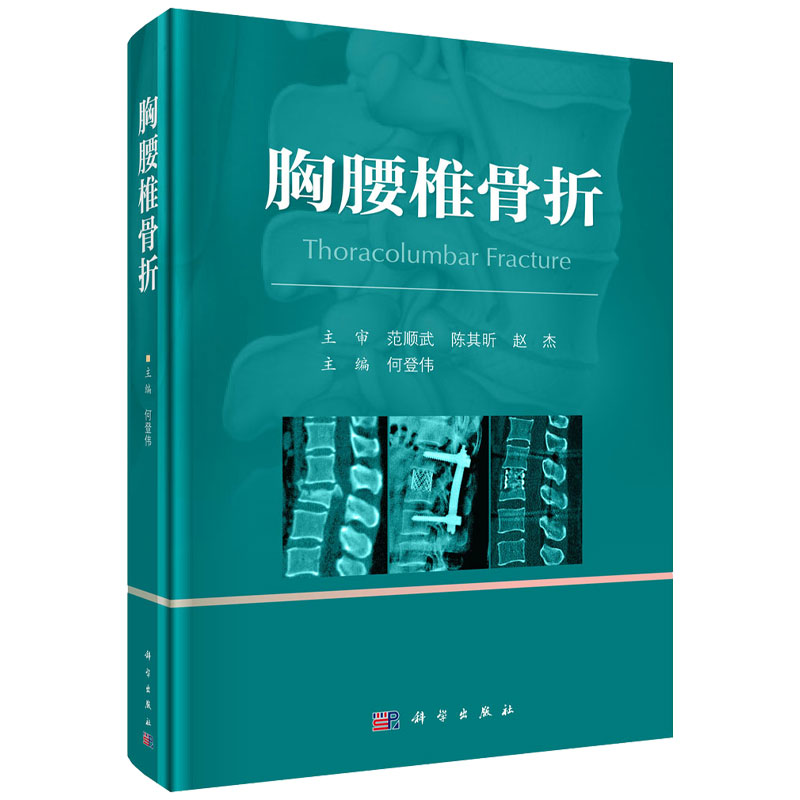 胸腰椎骨折 [正版]胸腰椎骨折 何登伟主编 胸腰椎骨折的概况 相关生物力学 体格检查和影像学检查等 胸腰椎骨折的损伤程度高清大图