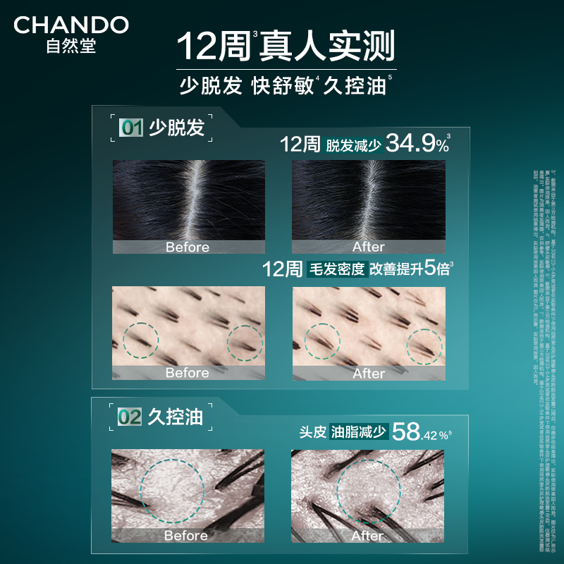 自然堂头皮护理敏感头皮防脱洗发露550mL-5027942001-NJYN高清大图