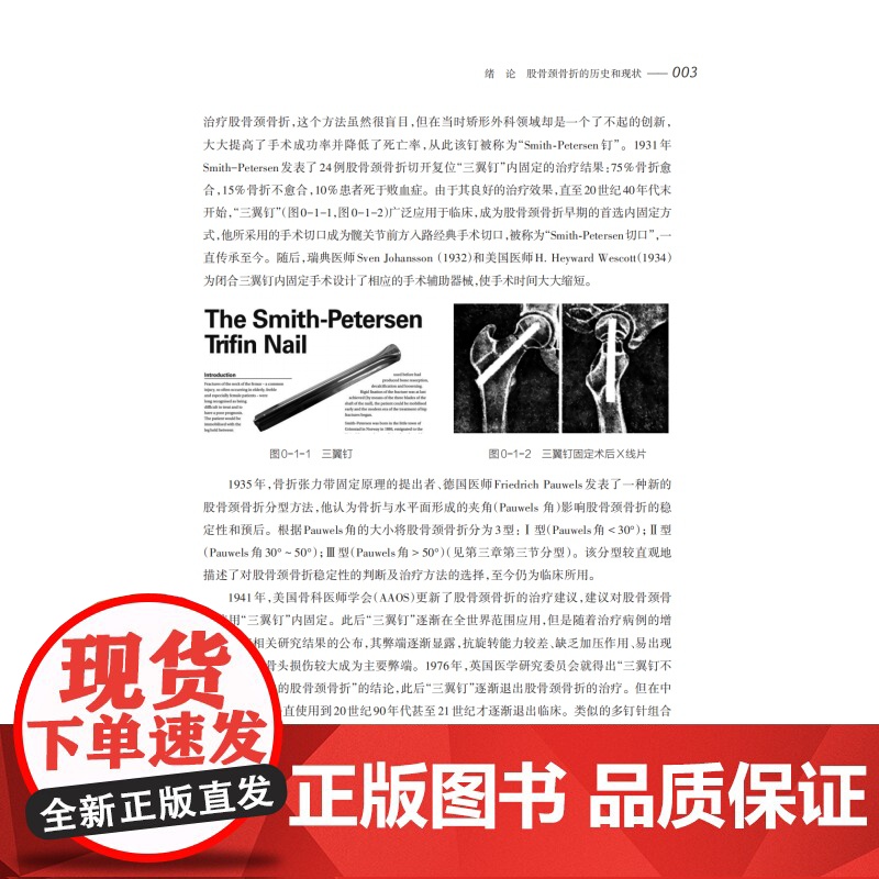 股骨颈骨折诊疗体系构建与新理念新技术 上海科技教育出版社外科学中西医股骨颈骨折院前处理评估康复护理正版医学书籍高清大图
