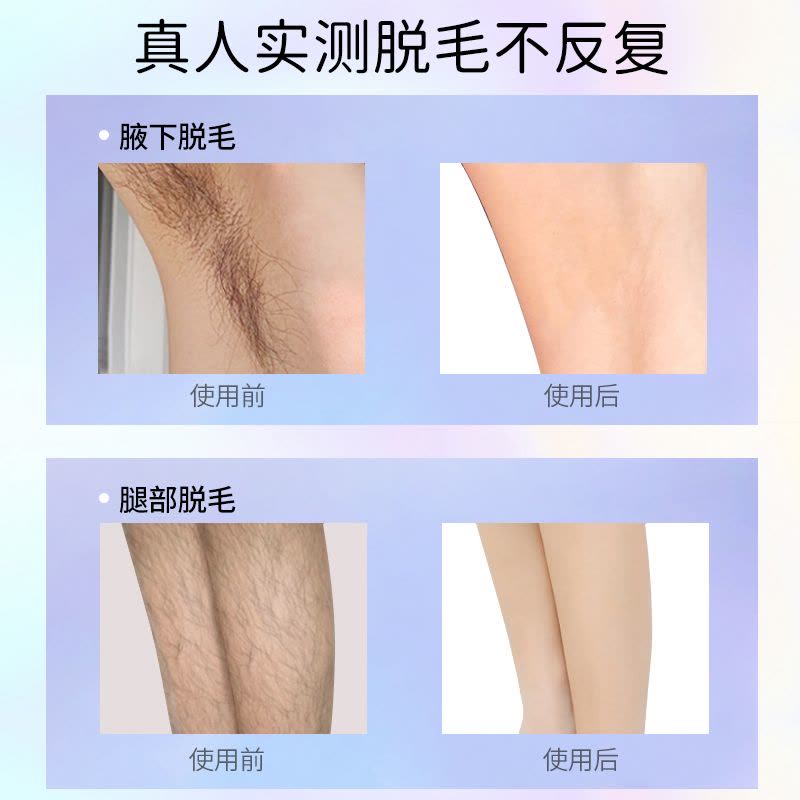 MAGITECH冰点脱毛仪腋毛刮毛剃毛器全身家用私处脱毛机私秘女专用图片