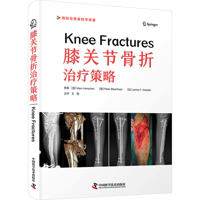 膝关节骨折治疗策略 (德)马克·汉斯,(德)皮特·比伯塔勒,(加)詹姆斯·P.瓦德尔 著 王刚 译 生活 文轩网