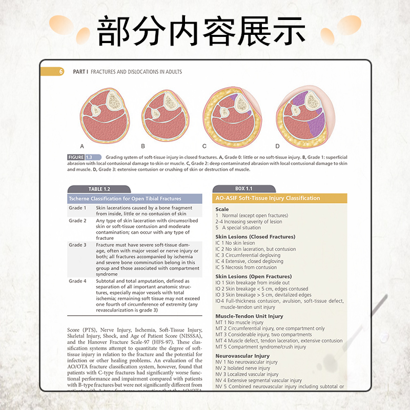 [正版]新版 坎贝尔骨科手术学 创伤与截肢 第14十四版全英版 临床外科医师quan威参考书籍馆配 人民卫生出版社97