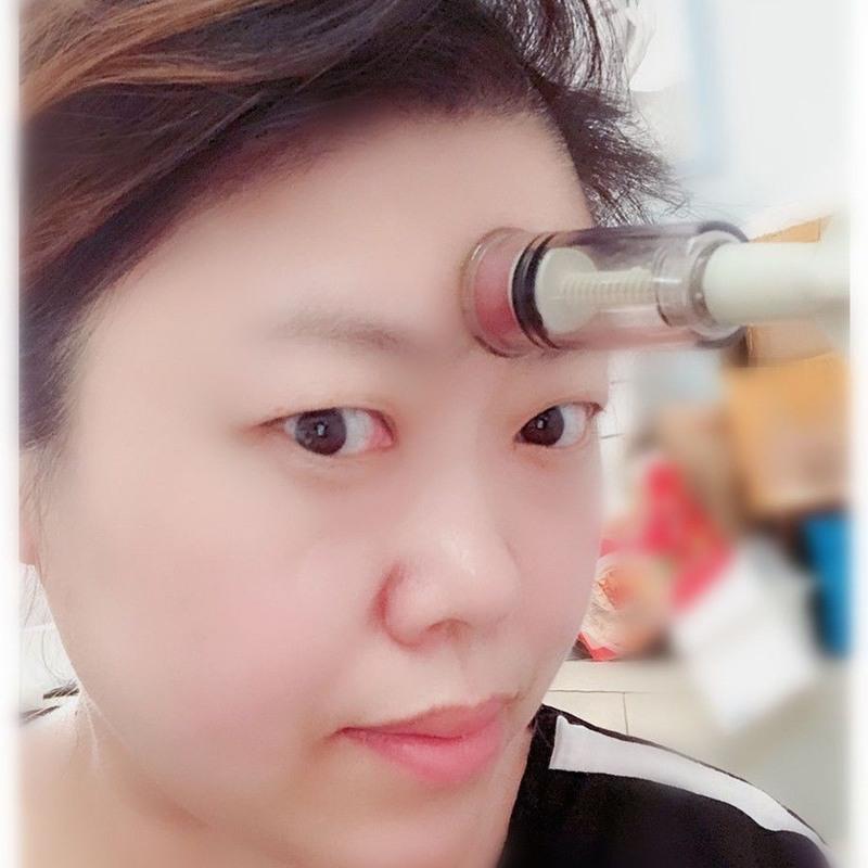 四号面部放血拔罐 直径2