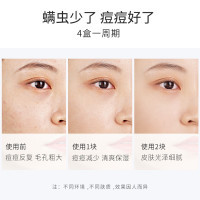 雪玲妃香皂芝士除螨皂洗脸皂洁面皂脸部面部女深层清洁男女100克
