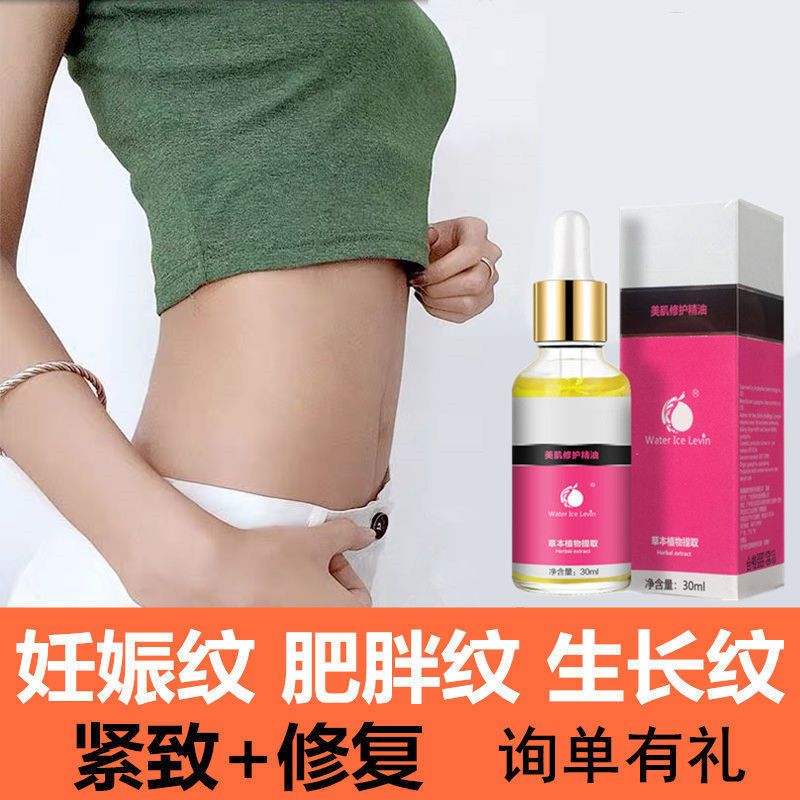 去妊娠纹产后修复霜紧致肚皮产前孕妇用品肥胖纹孕期预防专用 肌肤修护霜