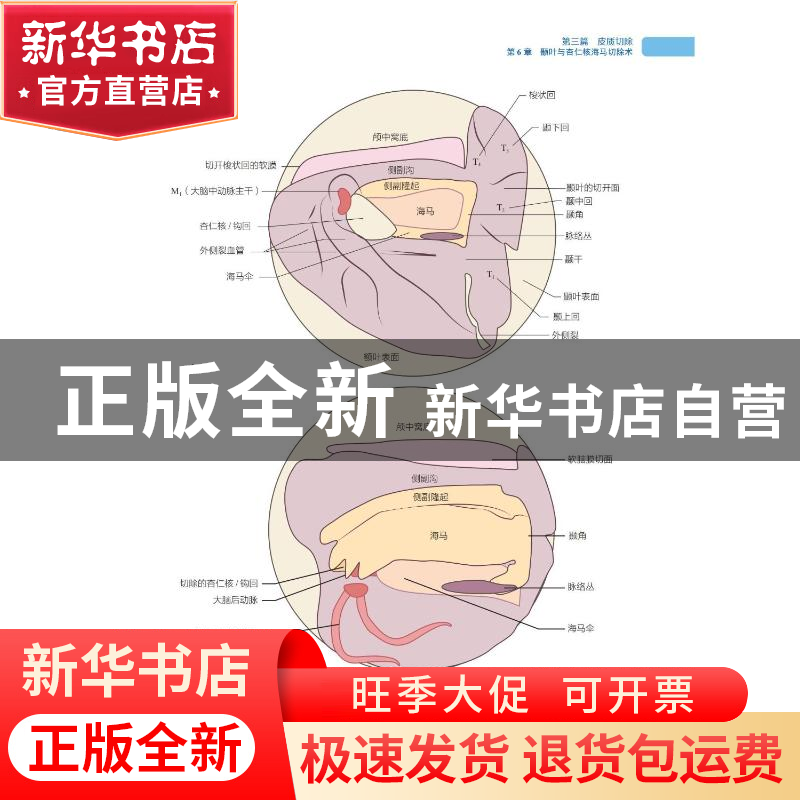正版 癫痫外科手术技术 [美 ]Gordon H. Baltuch 中国科学技术出高清大图