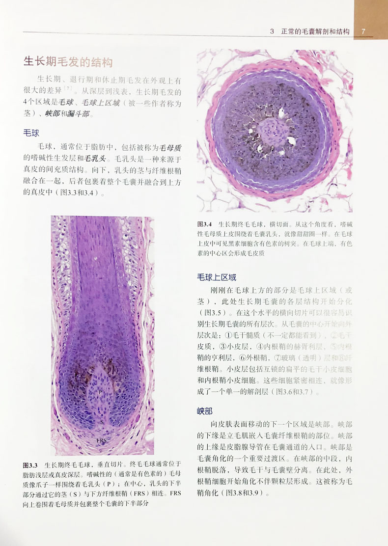 [醉染正版]毛发病理学及相关临床表现图谱 第2二版 杨淑霞主译 临床实用医学书籍 北京大学医学出版社9787565918高清大图