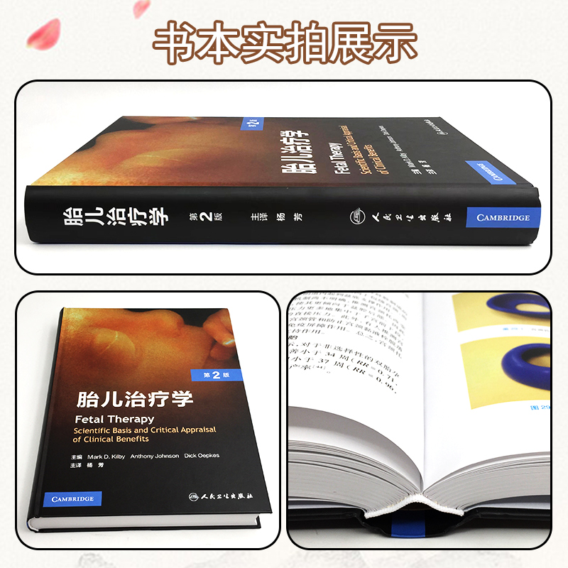 [正版] 胎儿治疗学第2版 人民卫生出版社9787117332460高清大图
