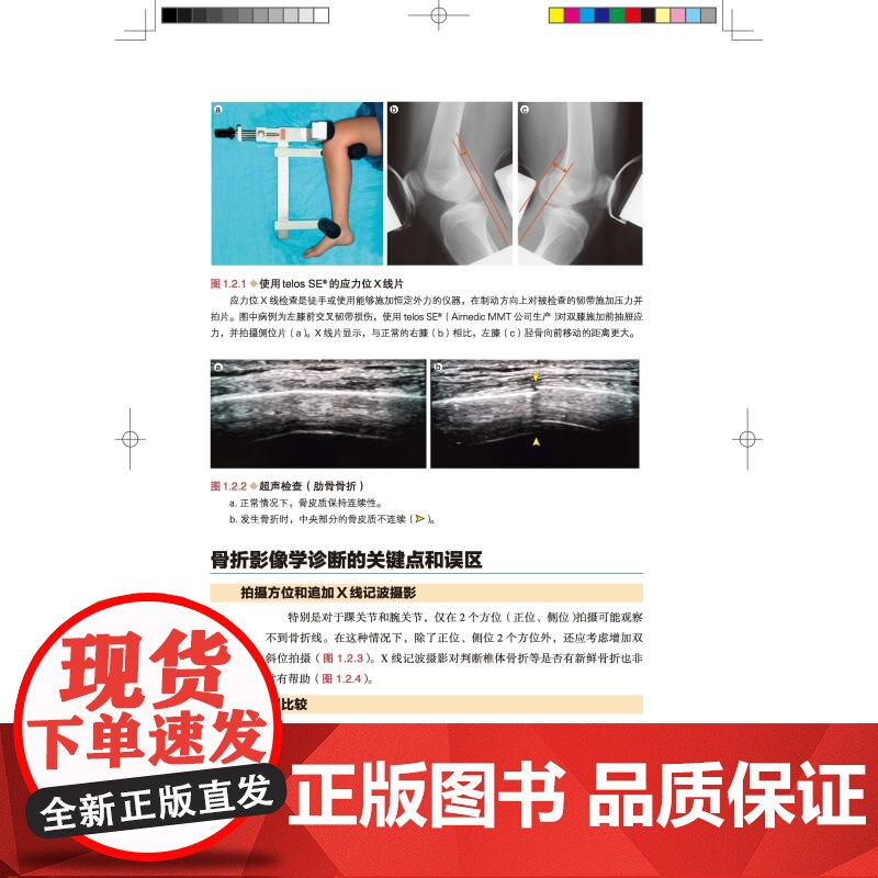 骨折 脱位 损伤:影像诊断及治疗图解 详细分型 高清图片 视频演示 北京科学技术高清大图