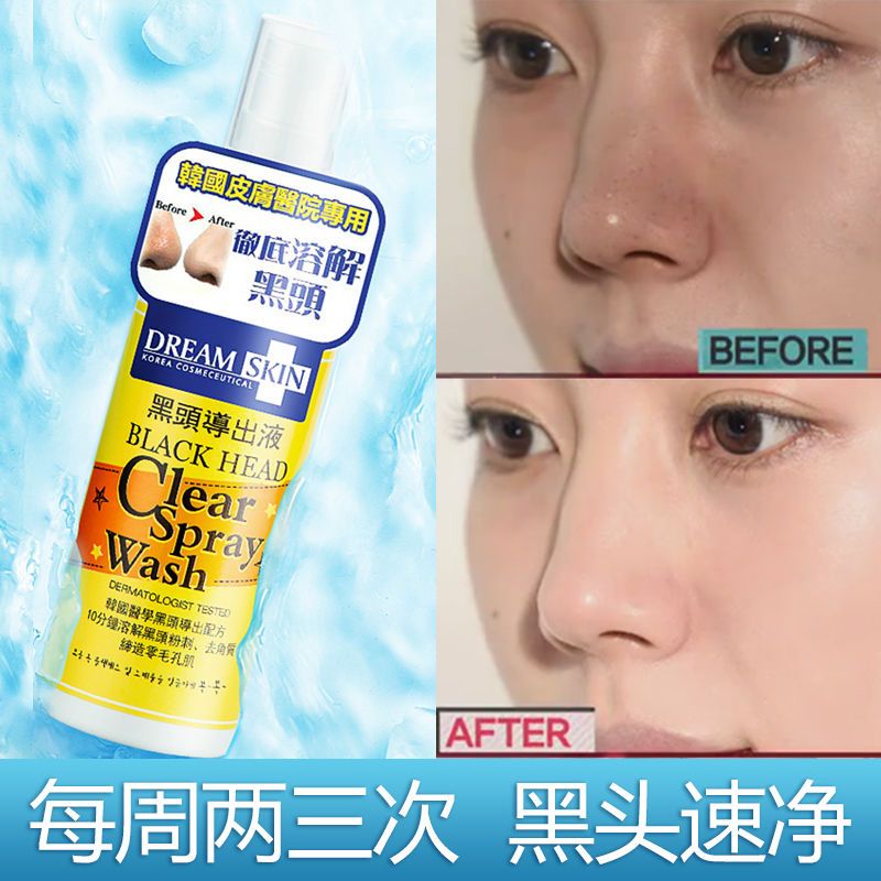 品牌授权/Dream Skin梦诗肌去黑头导出液收缩毛孔袪白头粉刺男女 品牌授权/Dream Skin梦诗肌去黑头导出液