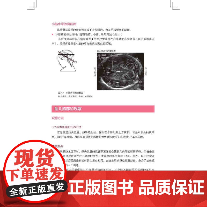 胎儿超声扫查技巧图解 胎儿 超声 扫查 技巧 北京科学技术高清大图