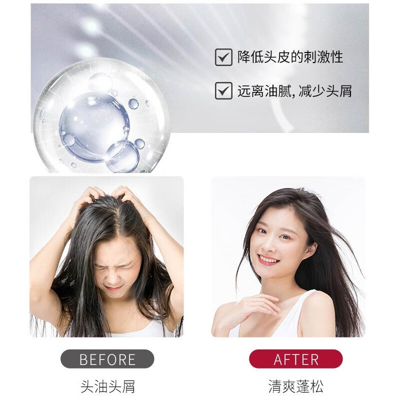 舒蕾头皮舒爽控油去屑洗发露430ml(NM)高清大图