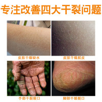 雷曼皲裂膏护肤乳膏 手足皲裂膏皲裂霜防皲裂手脚干裂粗糙手脚开裂手足护手霜润体霜25g