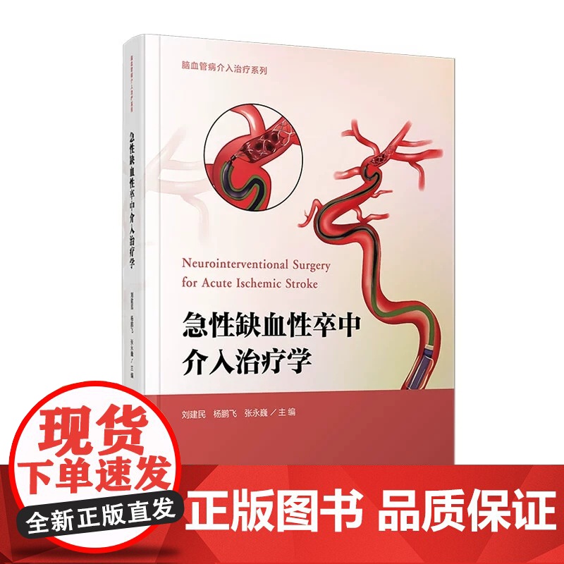 急性缺血性卒中介入治疗学(脑血管病介入治疗系列) 刘建民,杨鹏飞,张永巍 复旦大学出版社 脑血管 疾病治疗 医学高清大图