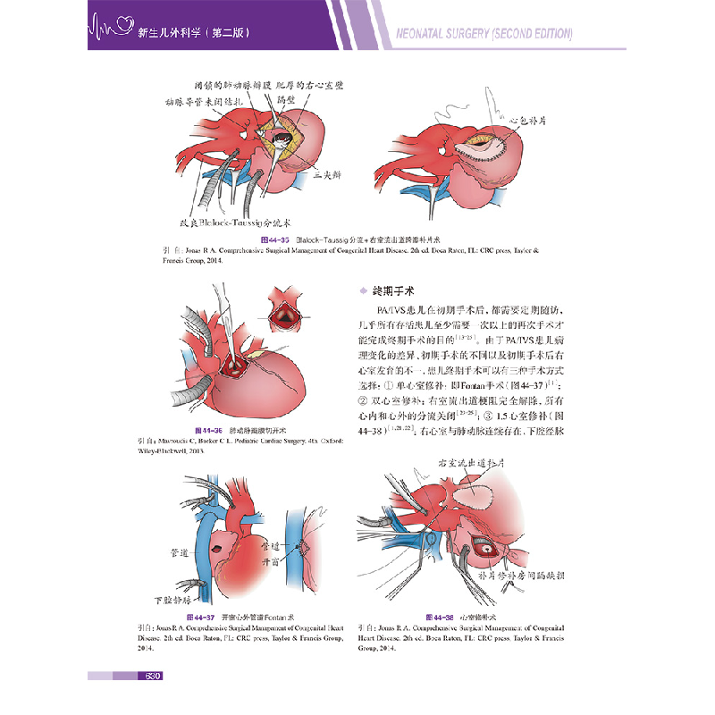醉染图书新生儿外科学(第二版)9787519262471高清大图