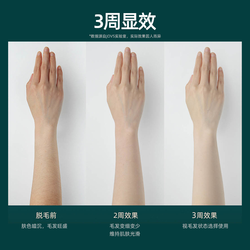 JOVS剃/脱毛器Dora报价_参数_图片_视频_怎么样_问答-苏宁易购