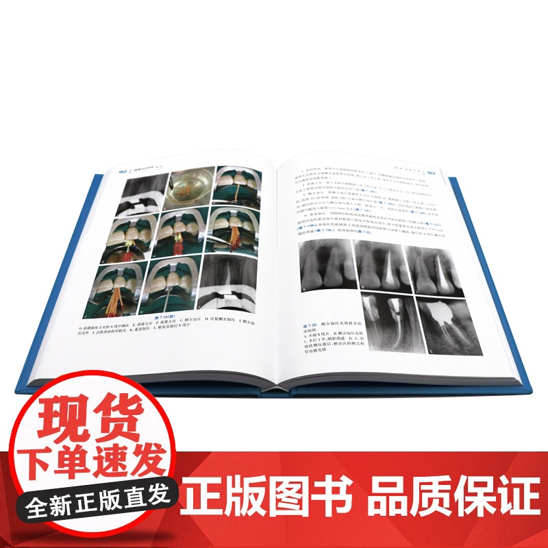 根管治疗图谱第2版二版彭彬口腔临床操作技术牙科正畸种植基础知识现代标准程序临床操作视频锥形束牙体牙髓再生牙齿周病学人卫高清大图