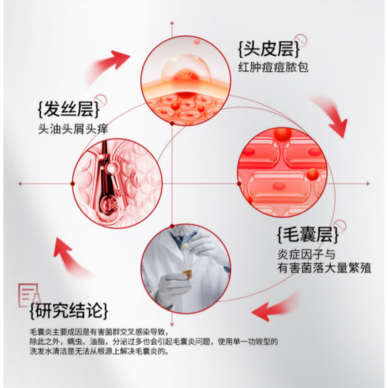RUYI儒意二硫化硒去屑控油洗发水800g高清大图