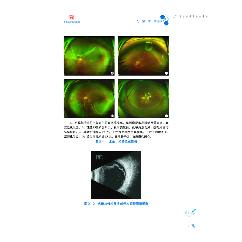 醉染图书陕西省眼科医院病例精解9787518972074高清大图
