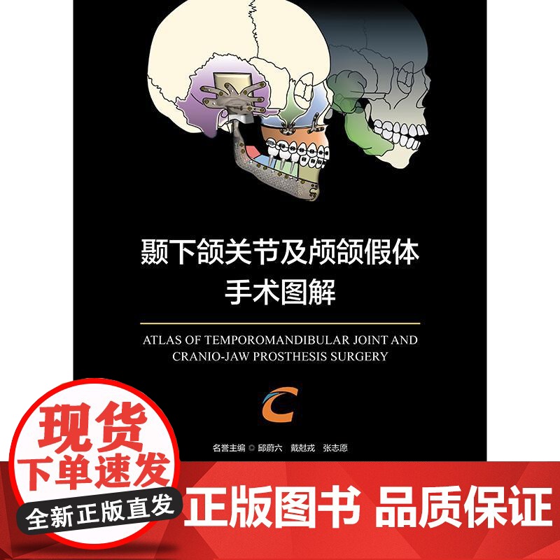 颞下颌关节及颅颌假体手术图解 杨驰 人卫数字资源 人民卫生出版社9787117376914高清大图