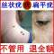 1盒体验装 去除脸部扁平疣丝状疣脖子手脚肉刺瘊子跖疣私处疣腋下身上寻常疣