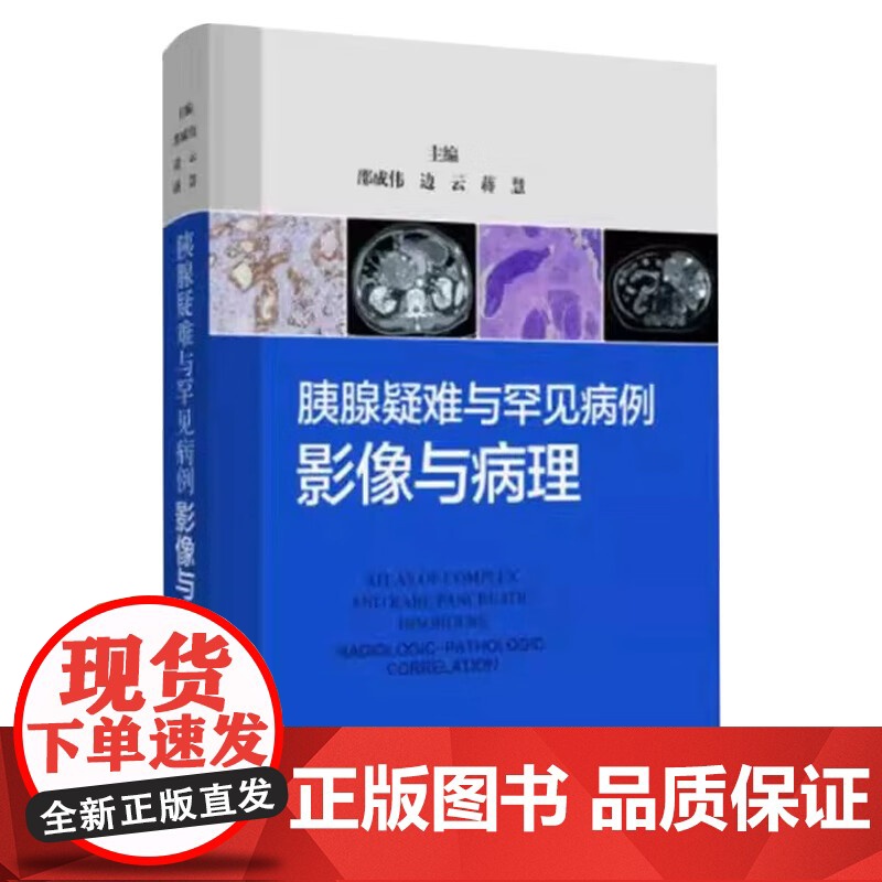 胰腺疑难与罕见病例:影像与病理 邵成伟 边云 蒋慧 精选135例胰腺疑难与罕见病例 深度融合影像与病理资料 上海科学技术高清大图