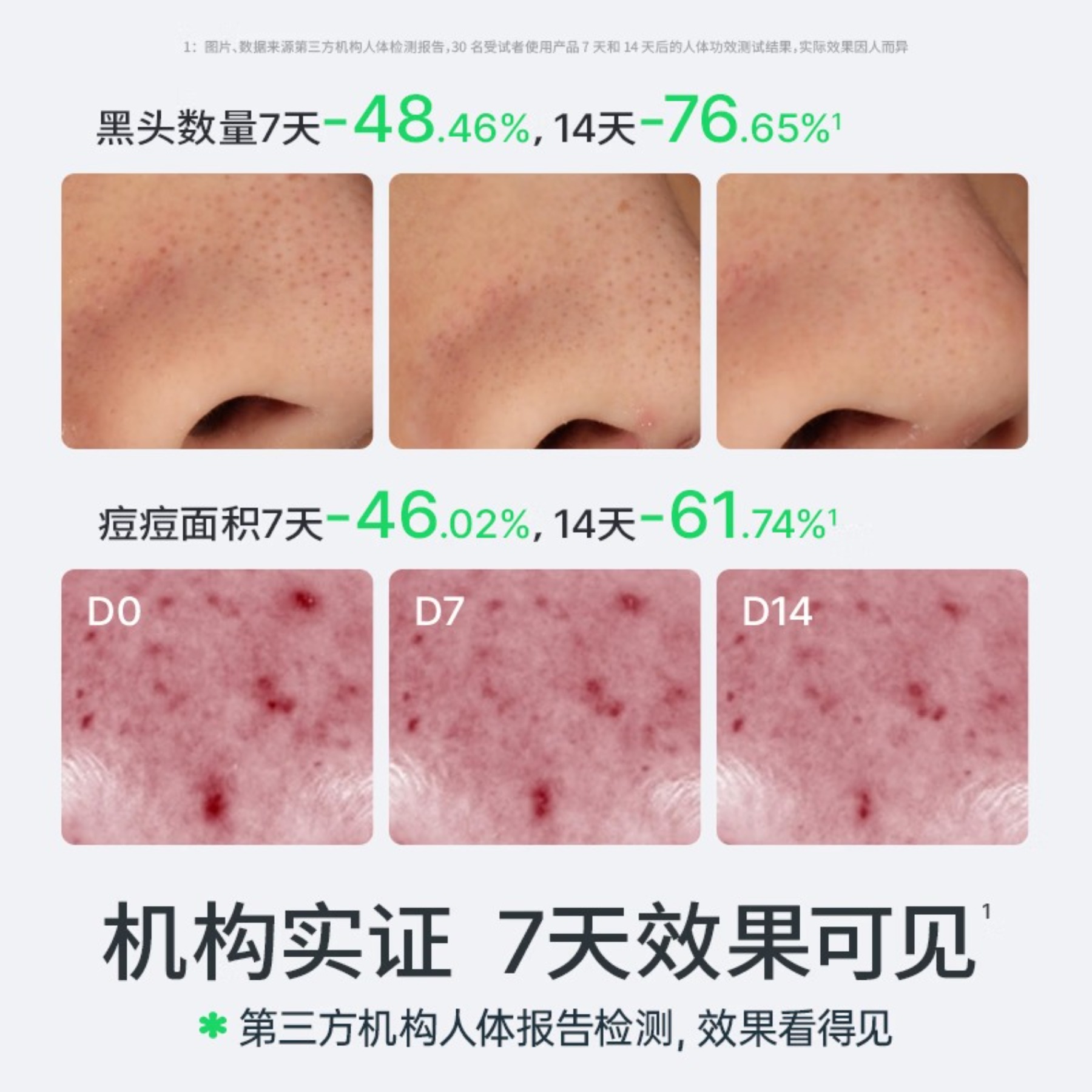 Hi!papa海龟爸爸青少年洗面奶洁面男孩控油祛痘护青少年女孩护肤品80g高清大图