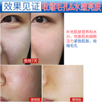 6盒 妍瑟 冻干粉多肽滋养精华液修护受损肌肤祛痘坑痘印红血丝滋养保湿适用各种肤质男女通用