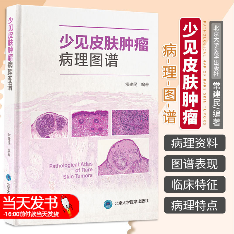 [醉染正版]正版 少见皮肤肿瘤病理图谱 常建民 北京大学医学出版社 适合皮肤科医师以及病理科医师参考使用 佩吉特样鲍恩病高清大图