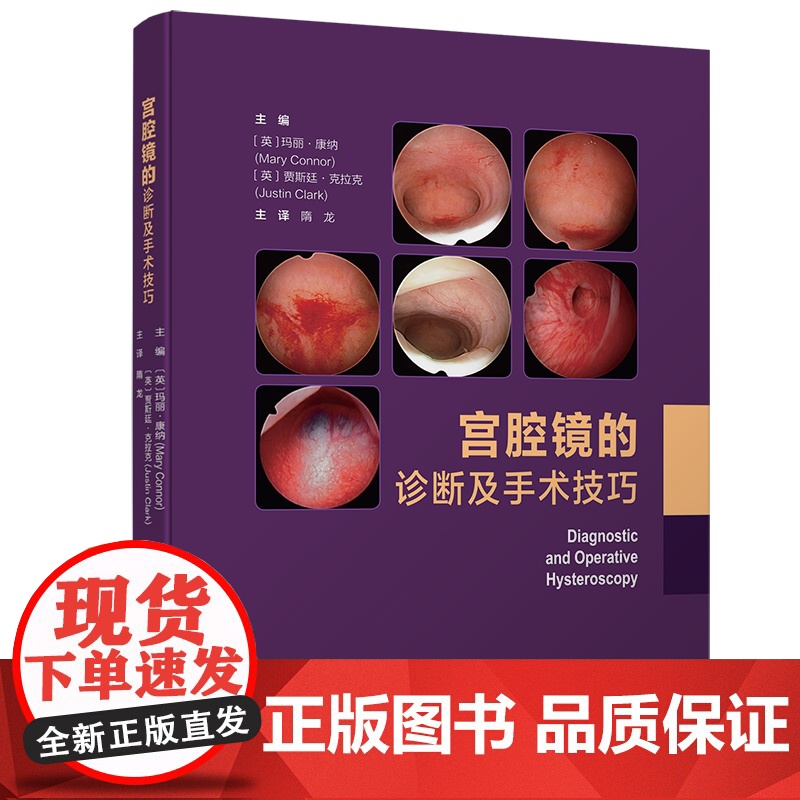 宫腔镜的诊断及手术技巧 子宫疾病 内窥镜检 妇科外科手术 北京科学技术高清大图