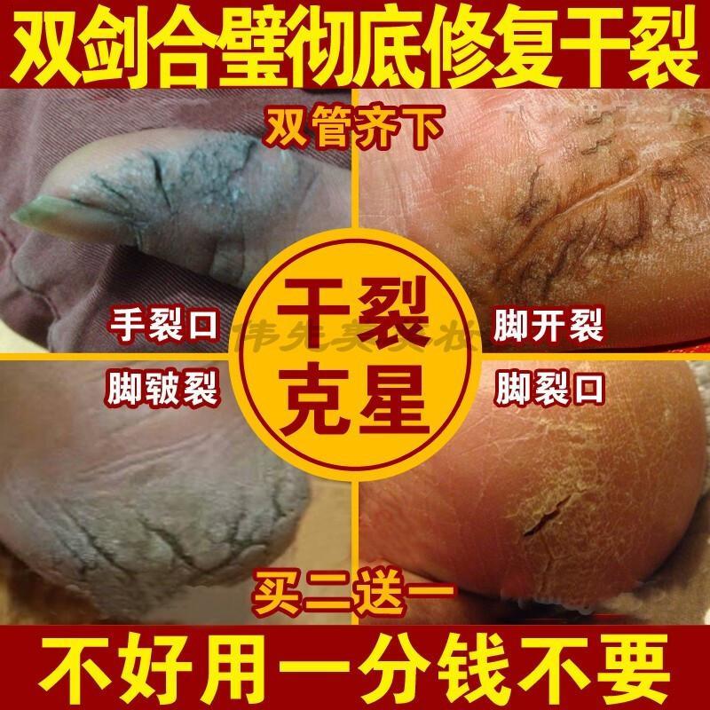 七安堂手足皲裂膏七安堂手裂脚裂膏干裂手足底脚后跟干燥防开裂口皲裂