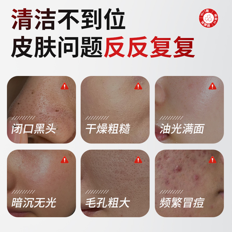 FONCE梵西 高岭土壬二酸净透清洁泥膜棒 黑头闭口粉刺收缩毛孔 控油涂抹清洁面膜 40g