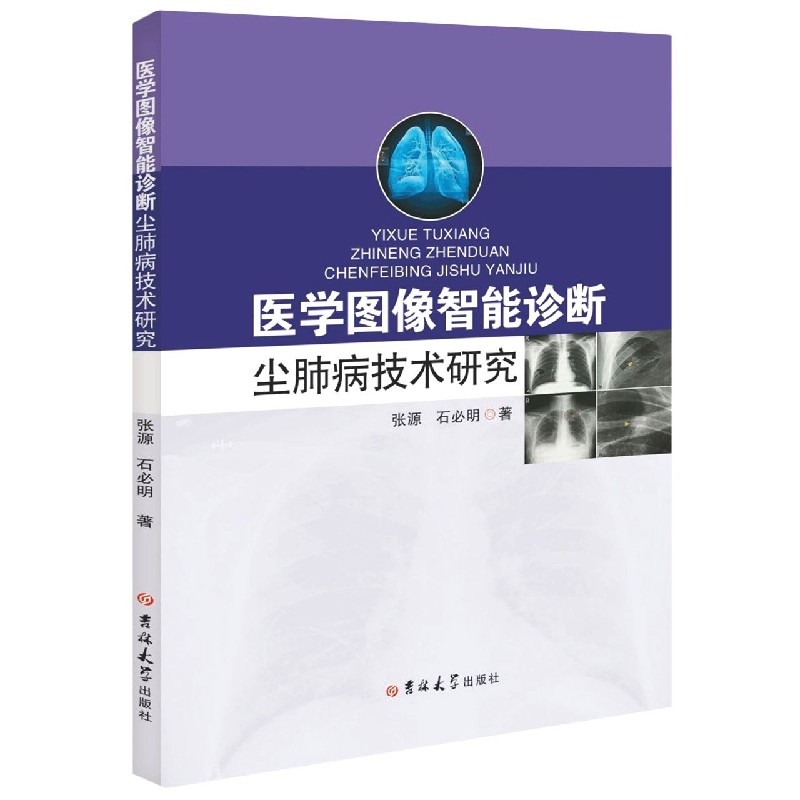 音像医学图像智能诊断尘肺病技术研究张源//石必明|责编:李欣欣