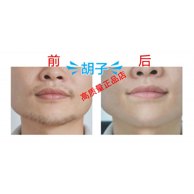 胡子专用脱毛绝毛膏永久脱毛膏去除脸部胡子胡须络腮胡男士学生用