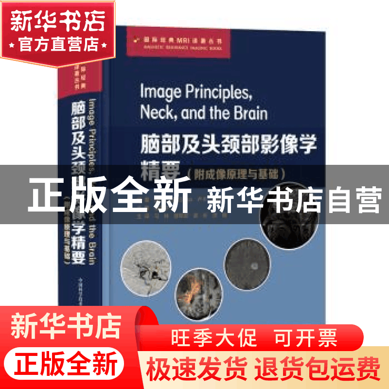 正版 脑部及头颈部影像学精要(精)/国际经典MRI译著丛书 [意]卢卡图片