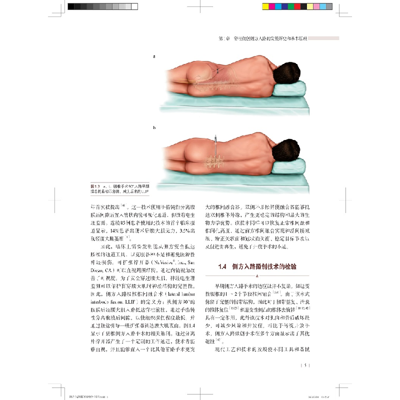 醉染图书侧方入路微创脊柱外科学9787547853887高清大图