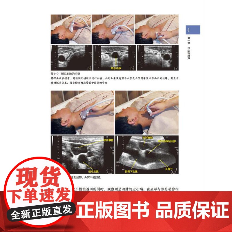 血管超声扫查技巧及诊断图解 日本持续 超声扫查技术丛书 血管解剖—扫查方法—诊断要点 一看就明白准确操作 抓住诀窍高清大图