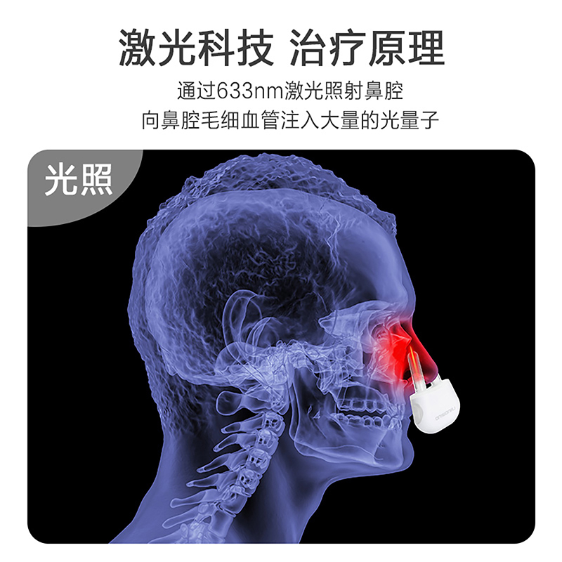 蓝韵 家用鼻炎治疗器鼻子光疗仪 激光理疗仪儿童成人可用AF-GLY/I