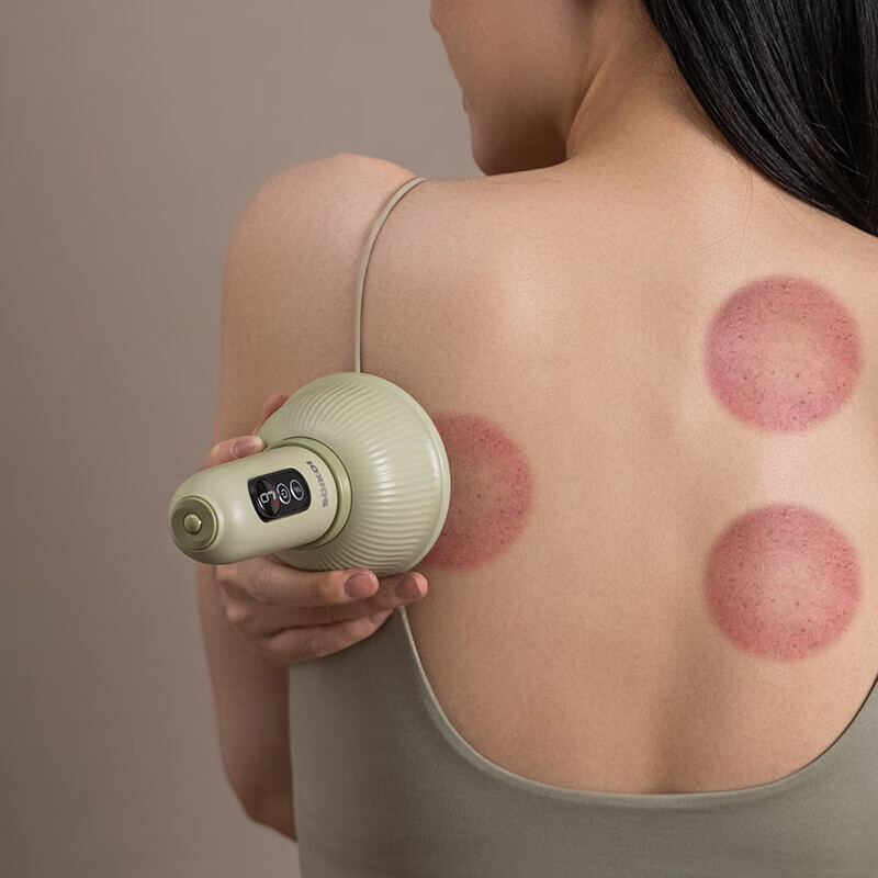 SOIKOI司崎库 电动拔罐器礼盒 S16(绿色)高清大图