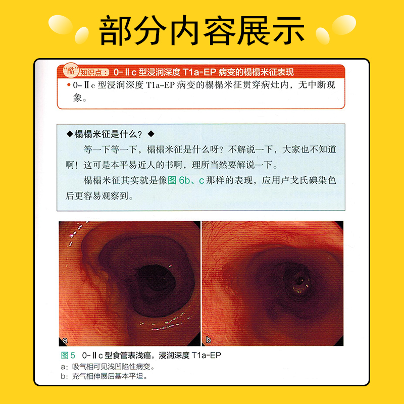 [正版] 上消化道内镜诊断的秘籍 主译宫健 刘石 消化系统疾病临床案例诊治教程参考工具书 辽宁科学技术出版社97875高清大图