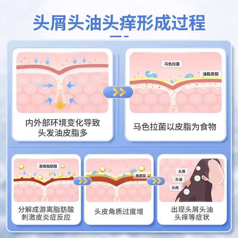希尔生二硫化硒 洗剂洗头水150g去头皮屑皮炎迪赛诺正品洗发水有效去头屑止痒