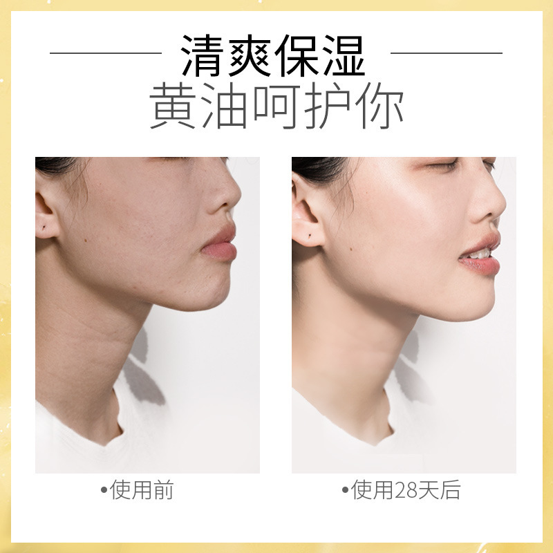 莱蔻秋冬季清爽补水保湿乳液小黄油100ml 面霜女润肤乳学生