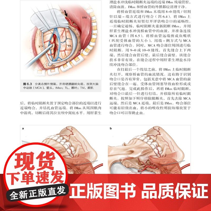 颅底外科手术的血管挑战 初中级神经外科医师内镜颅底外科领域重要参考书解剖肿瘤搭桥动脉瘤静脉神经电生理监测 辽宁科学技术出高清大图