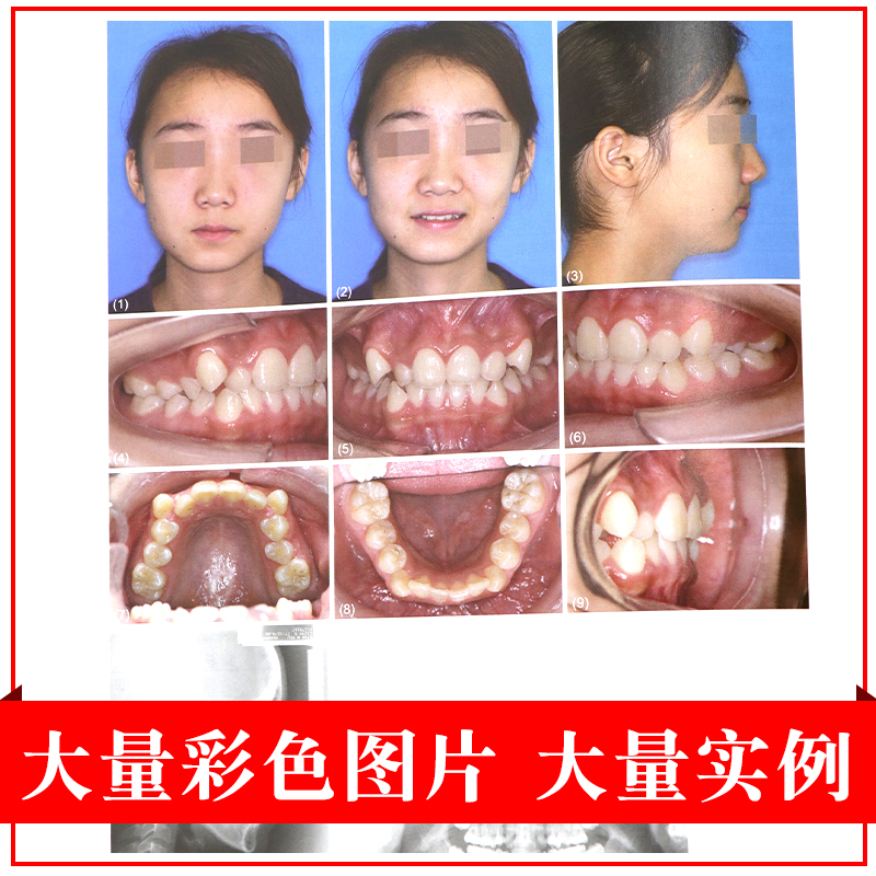 [正版]现代口腔正畸学 第5五版口腔颌面正畸学当代专科临床教程书籍颌面外科学手术图解面部解剖书创新弓丝弯制矫治技术隐形北高清大图