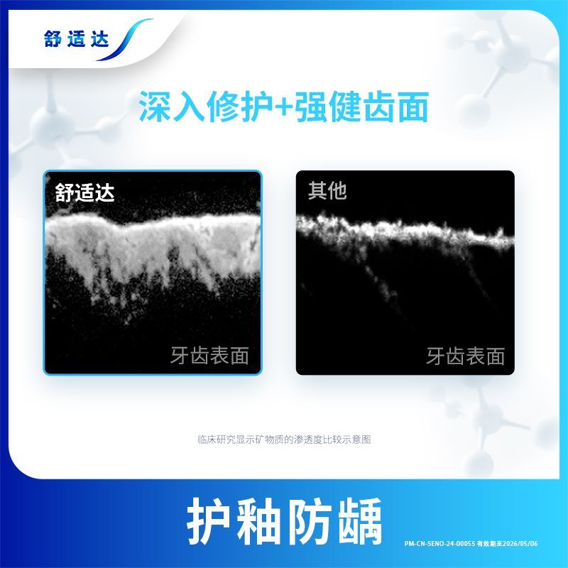 劲速+牙龈高清大图